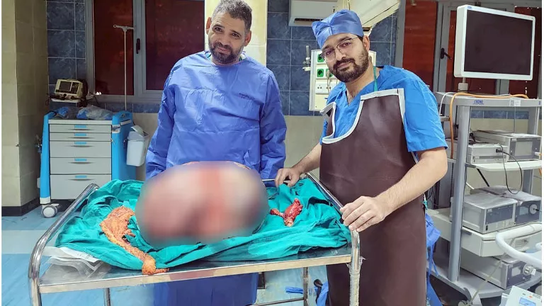 بعد استئصال ورم ضخم يزن 24 كيلو.. تكريم فريق طبي بجامعة المنيا